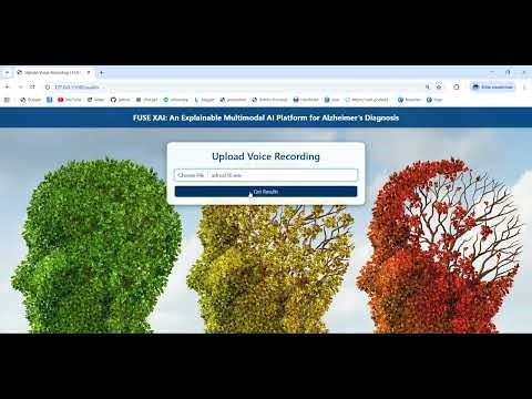 Alzheimer Text Image Audio Multi Model Alzheimer text- image -audio multi model concept