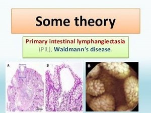 Primary Intestinal lymphangiectasia Or Waldmann disease ; Definition, Causes, Symptoms, Treatment