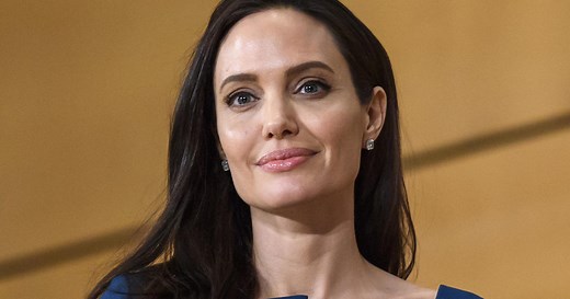 Dr. Agus on Bell's palsy treatment