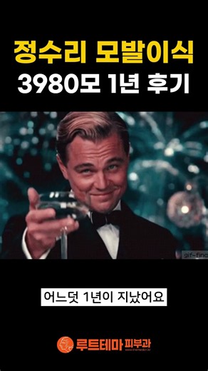 정수리 모발이식 3980모 1년 후기