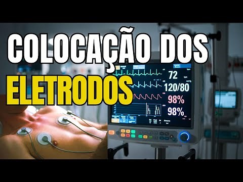 Monitorização Cardíaca: O GUIA DEFINITIVO para a Aplicação Correta de Eletrodos!