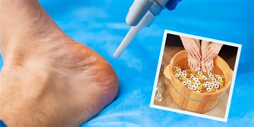 Follow These Expert Advised Dos And Don'ts For Diabetic Foot Care