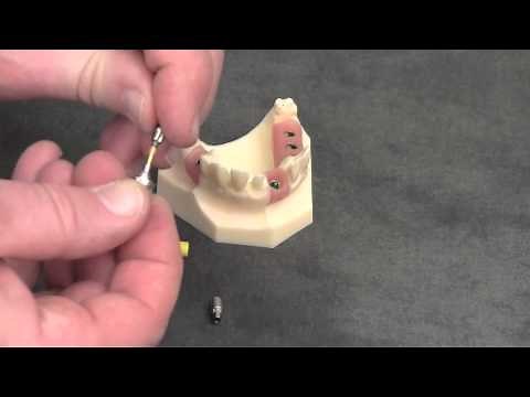Snappy Abutment Tutorial