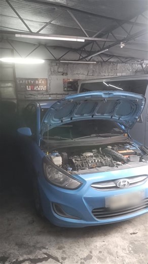 Intensive Pms done on Hyundai accent ☺ Carbon buildup removal: Turbo, EGR, Intale manifold, throttle body & intercooler 🚗 Thank you for trusting Stingray performance intake 🙏 | Stingray Performance Intake