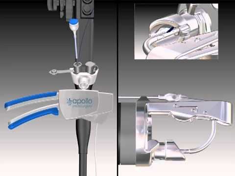 OverStitch™ Animation - Suturing Mechanism