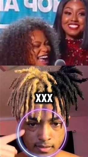 XXXTENTACION’s Most Emotional Award Moment 💔🕊️#shorts