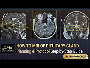 Pituitary gland MRI scan protocols, positioning and positioning
