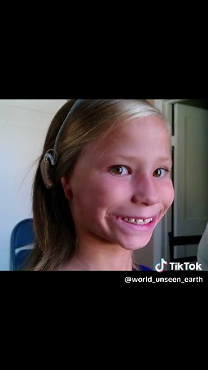 Inspiring Stories of Resilience: People Without Body Parts