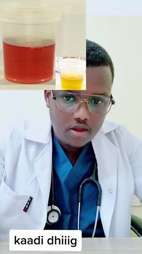 Understanding Medical Procedures with Liquid Samples