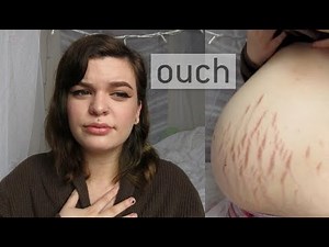 32 WEEKS PREGNANT! So Much Pain!