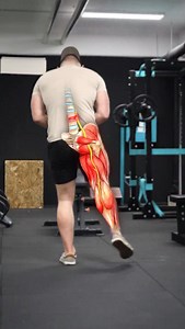 What Type Of Sciatica Do You Have?? 😨 Here’s how to assess what type of sciatica you’re dealing with and how to fix it: 1️⃣ Discogenic Sciatica If your pain is sharp & worsens with bending forward, you might have a bulging or a herniated disc compressing your sciatic nerve. 2️⃣ Pseudo Sciatica If your pain is dull & worsens with sitting, but improves with stretching you might have a tight or inflamed muscle compressing your nerve 3️⃣ “Stenotic” Sciatica If your pain worsens with extension or wh