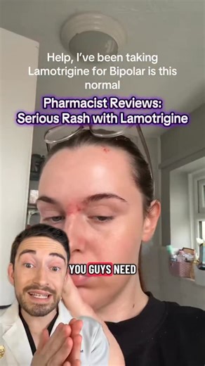 Dr. Ethan Melillo | Pharmacist on Instagram: "She developed a rash after starting Lamotrigine 😳 Could it be Stevens-Johnson Syndrome (SJS)? I explain how this reaction happens, the early warning signs to watch for, and how it’s managed. * This video is for educational purposes only and is not a substitute for medical advice. Always talk to your doctor or pharmacist about your personal health needs. #Lamotrigine #SJS #StevensJohnsonSyndrome #Pharmacist #MedicationSafety #DrugReactions #PharmacyE