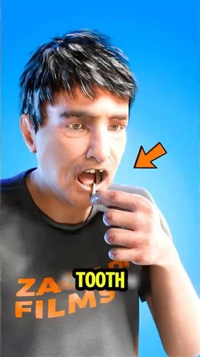 DON’T PANIC! How to Save a Knocked Out Tooth 🦷😱