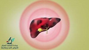 19 reactions · 8 comments | التهابات الكبد الوبائية او الفايروسية...