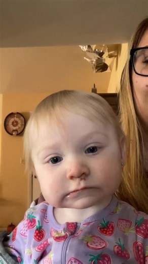 Journey of Healing After Cleft Palate Surgery