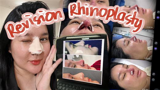 Hello sa inyo! Kamusta? We have a new video today! Shop Moringa-O2 now! https://s.lazada.com.ph/s.66kjj Products Mentioned: Moringa-O2 Herbal Therapy Oil for Hair, Scalp, and Skin https://bit.ly/3IMBFsW Blackening Shampoo: https://bit.ly/3IRWZNJ Moringa-O2 Skincare line https://s.lazada.com.ph/s.66kjj Moringa-O2 Herbal Moisturizing Lotion Moringa-O2 Herbal Moisturizing Soap Moringa-O2 Herbal Facial Toner Where I buy Gold SKYLOVE.PH GOLD Jewelry Shop https://bit.ly/3xrGwdi Vlog Intro and Outro ht