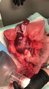 This Is How The Lungs Work