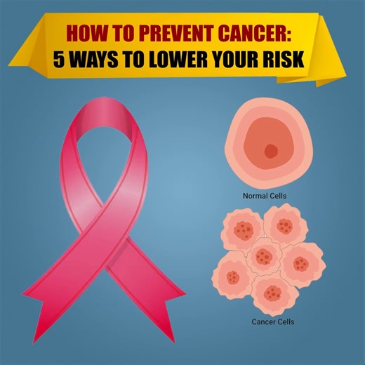 How To Prevent Cancer: 5 Ways To Lower Your Risk | Health