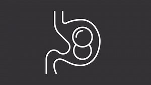 Bloating White Line Animation Animated Stomach Stock Footage Video (100% Royalty-free) 3646406403 | Shutterstock