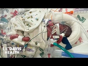 Baby Born at 22 Weeks Saved by Sacramento Firefighters and UC Davis Children's Hospital