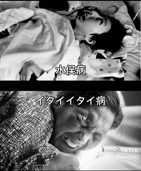 イタイイタイ病と水俣病を忘れないために