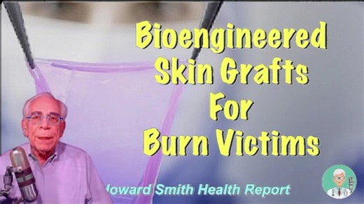 Bioengineered Skin Grafts For Burn Victims The treatment of severe burns requires replacement of destroyed skin with skin grafts. From the Swiss company Cutiss, a spin-off from the University of Zurich, comes better skin graft technology called DenovoSkin. Starting with a postage stamp-sized sample of a patient’s skin as a cell source, in just 4 weeks Cutiss can grow multiple, personalized bilayer skin grafts 10 times that size that have both epidermal and dermal layers. The result skin for graf