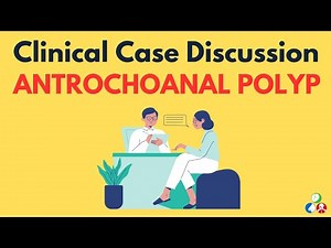 Antrochoanal Polyp - Clinical Case Presentation | Nasal Polyp | Long case Nose