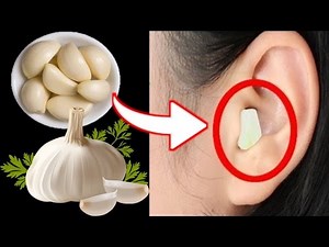 Put Garlic In Your Ear For 30 minutes And See what happens Next