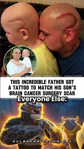 When Tattoos Speak Love | Father Matches Son’s Brain Surgery Scar 🧠✨