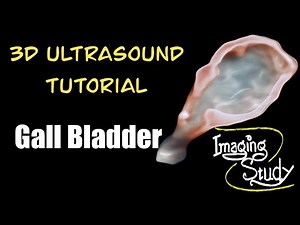 3D Ultrasound Tutorial: Gallbladder