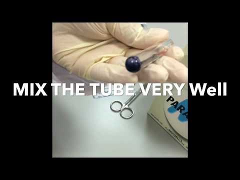 How to count reticulocytes