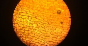 Observation of Plant & Animal Cells