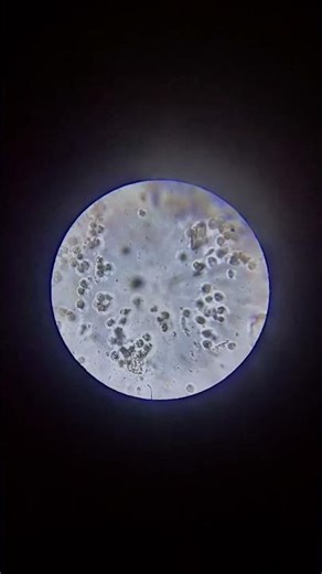 urine test microscope #medical #hospital #viral