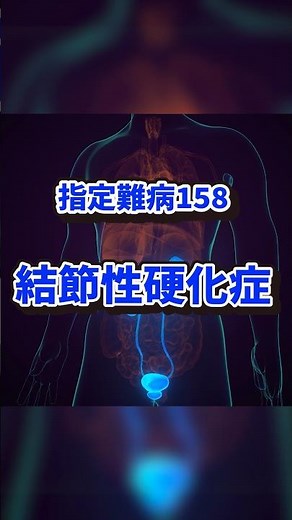 指定難病158 結節性硬化症とは？ #shorts #指定難病 #難病 #結節性硬化症