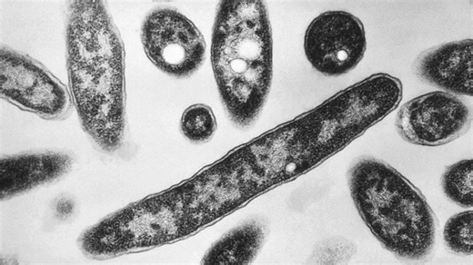 Legionnaires' disease case confirmed at Bronson Methodist Hospital in Kalamazoo