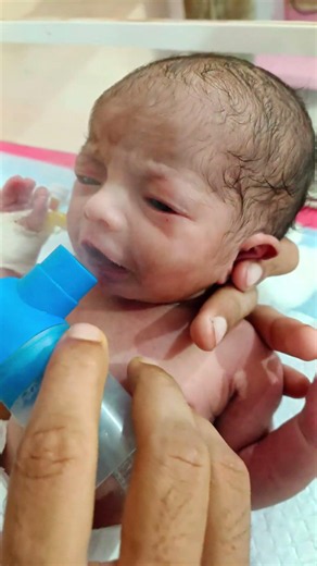 how to nebulization cutebaby #cutebaby #neonatologist #baby #babychoice