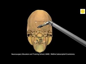 Neurosurgery 3D Animation Video : Midline Suboccipital Craniotomy