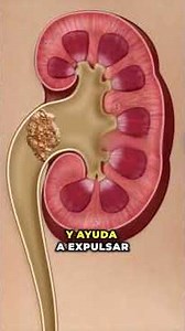 7 Natural Kidney Cleansing Remedies