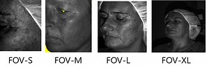 AEVA-HE High End 3D Skin Imaging Technology | 3D Skin Texture Analyzer