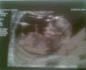 12. týden těhotenství