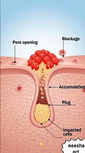 Pimples ka asli reason kya hai? 🤔 Science Explained!