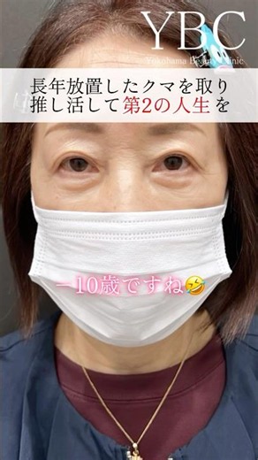 第二の人生を#クマ取り #目の下のクマ #目の下のたるみ取り #美容 #整形 #ybc横浜美容外科 #イソセン
