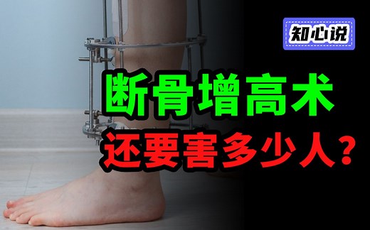 这个毁掉无数双腿的手术，每年还吸引着数千人去做【知心说】