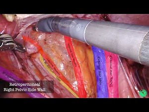 Anatomy Review: Gynecological Pelvic Structures • Video • MEDtube.net