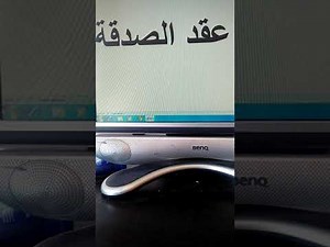 عقد الصدقة في القانون المغربي