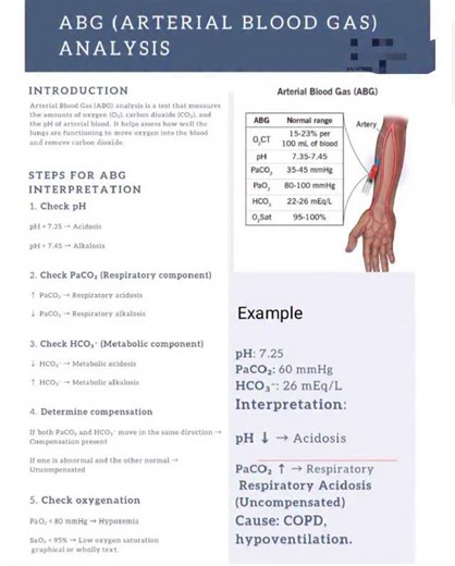 Faiza Khan on Instagram: "STOP PANICKING over ABGs! 🤯 If you can master these 5 steps, you can nail every Acid-Base problem on your exam!ABG analysis is non-negotiable in critical care. It assesses how well the lungs are moving oxygen and removing \text{CO}_2 and checks the body's acid-base balance. Follow this simple, stepwise method every time: Check pH: Determine if it's Acidosis ( 7.45). Check \text{PaCO}_2 (Respiratory): Does it align with the pH? (%uparrow \text{PaCO}_2 \rightarrow Respir