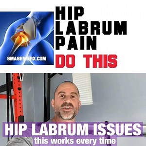 43 reactions · 12 shares | Hip labrum issues? Painful hips? Let’s...