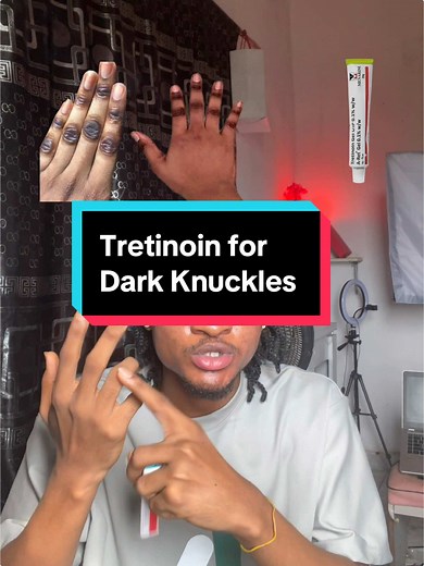 Tretinoin for Dark Knuckles: Effective Skin Transformation