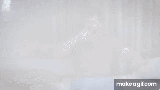 Test Patient A | Bush Francis Catatonia Rating Scale Test Patient A on Make a GIF