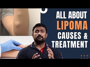 All about Lipoma - Causes & Treatment !!